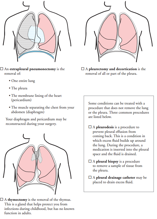 About Your Thoracic Surgery | Memorial Sloan Kettering Cancer Center